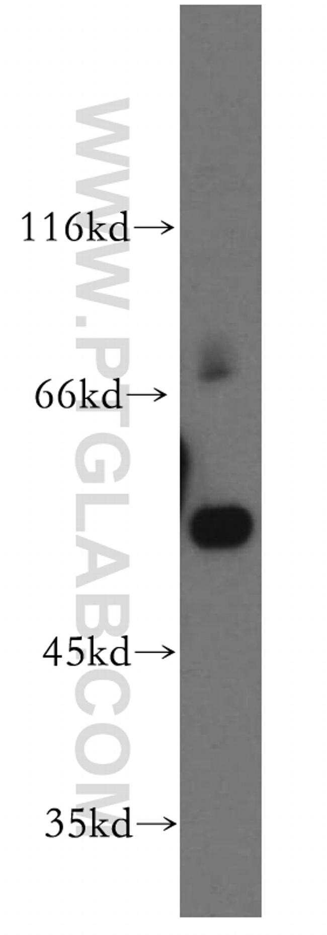 QRSL1 Antibody in Western Blot (WB)