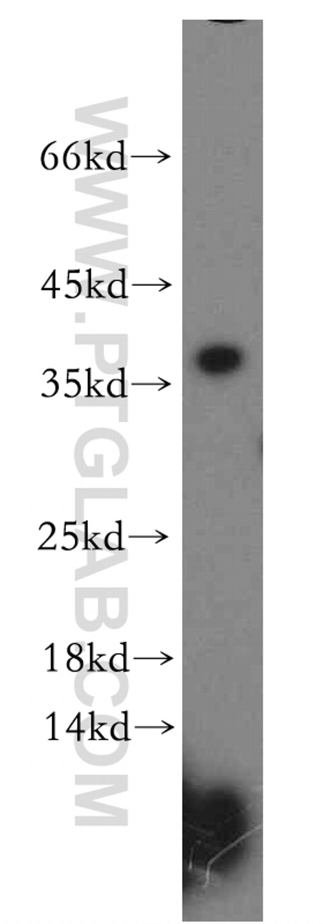 MED4 Antibody in Western Blot (WB)