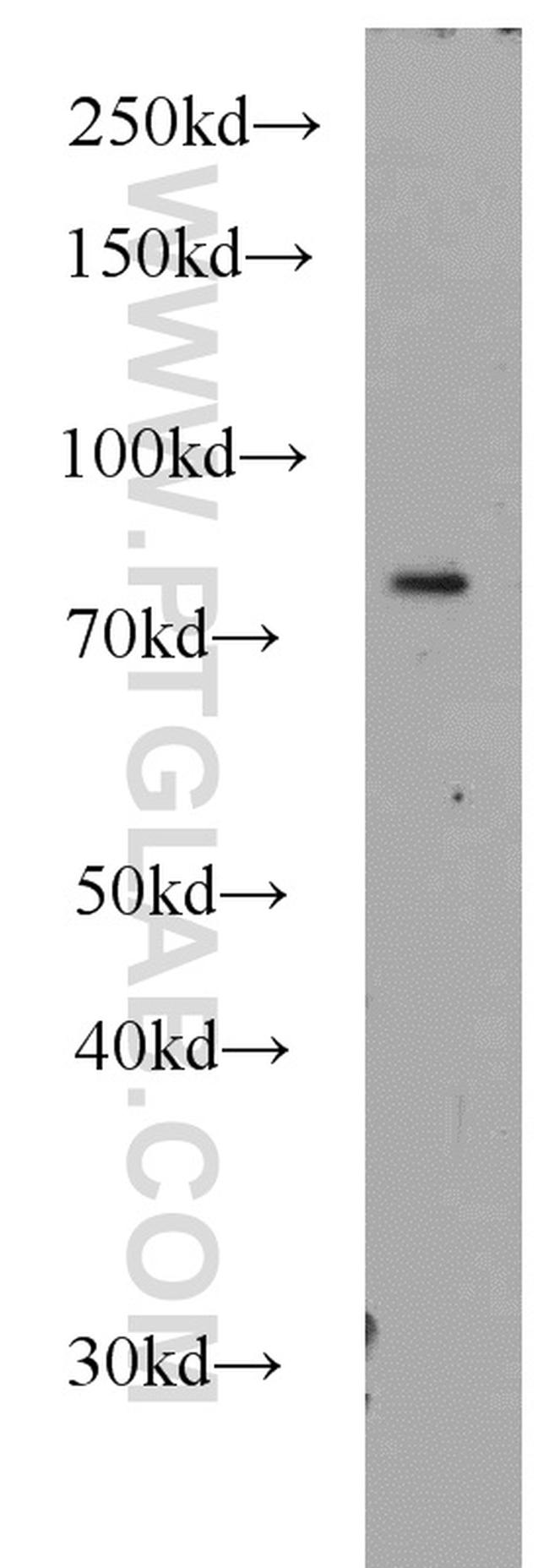 PLK2 Antibody in Western Blot (WB)