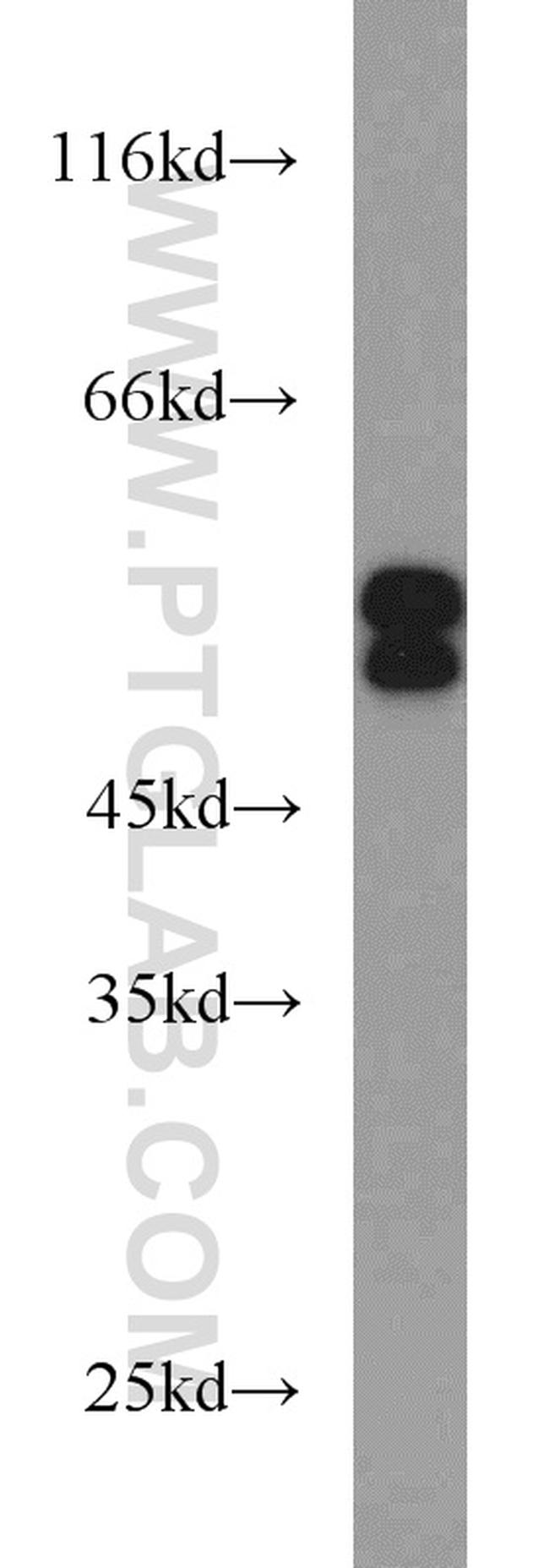 SH2D4A Antibody in Western Blot (WB)