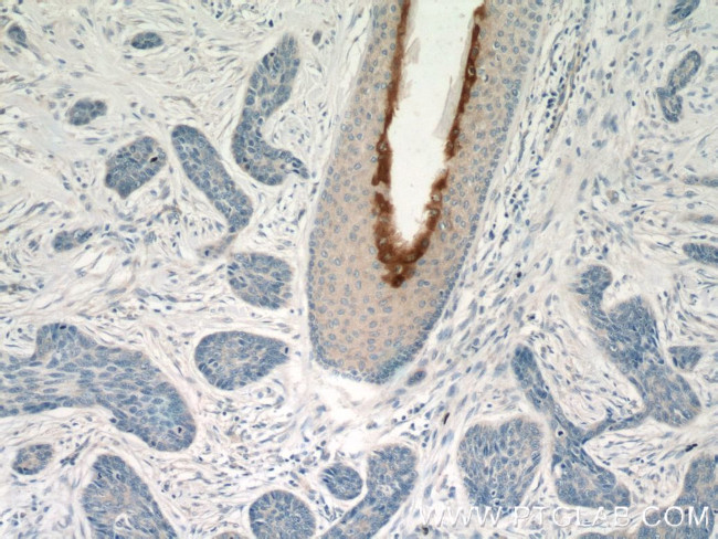 Elafin/Skalp Antibody in Immunohistochemistry (Paraffin) (IHC (P))