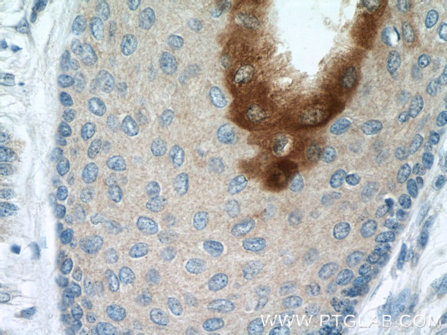 Elafin/Skalp Antibody in Immunohistochemistry (Paraffin) (IHC (P))