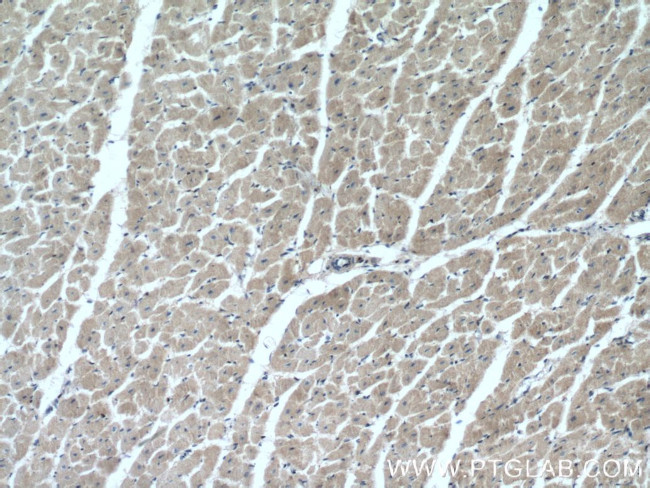 BNIP1 Antibody in Immunohistochemistry (Paraffin) (IHC (P))