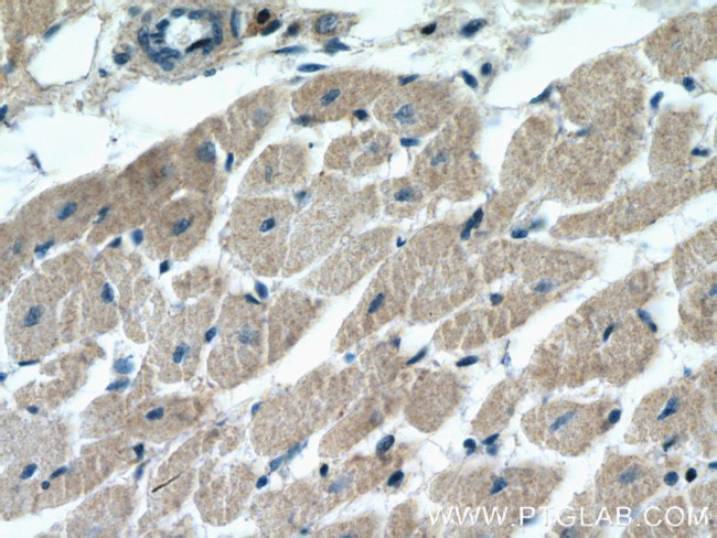 BNIP1 Antibody in Immunohistochemistry (Paraffin) (IHC (P))