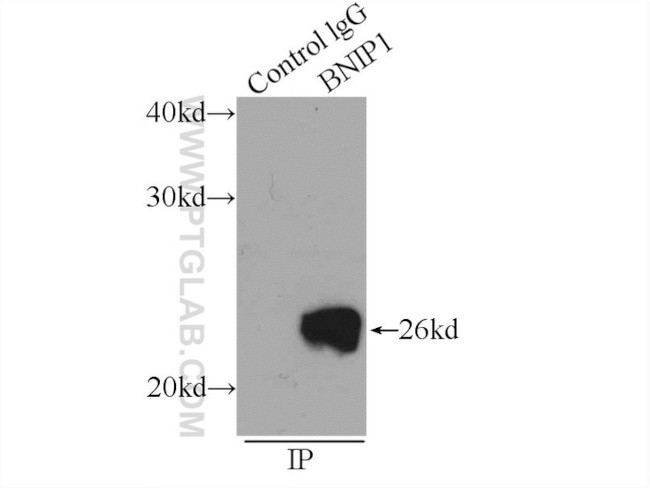 BNIP1 Antibody in Immunoprecipitation (IP)