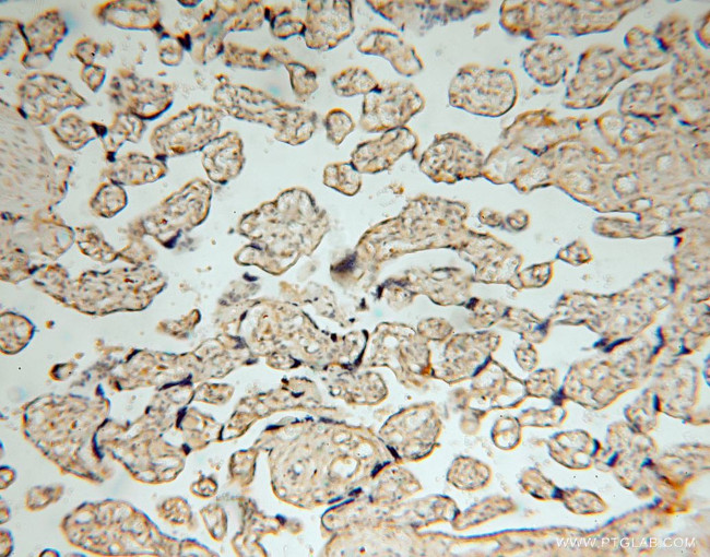 BHMT Antibody in Immunohistochemistry (Paraffin) (IHC (P))