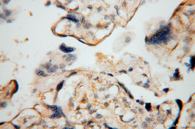 BHMT Antibody in Immunohistochemistry (Paraffin) (IHC (P))