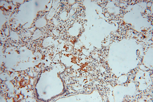 BHMT Antibody in Immunohistochemistry (Paraffin) (IHC (P))