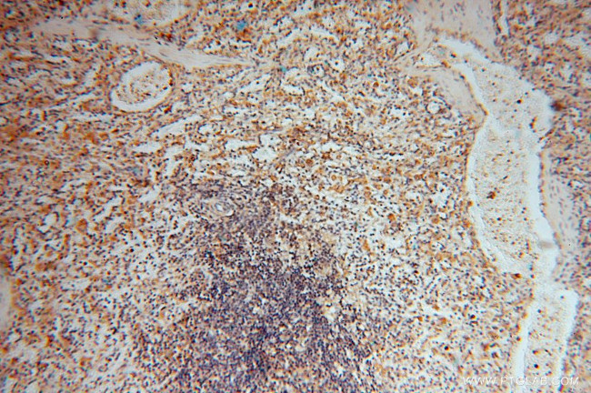 BHMT Antibody in Immunohistochemistry (Paraffin) (IHC (P))