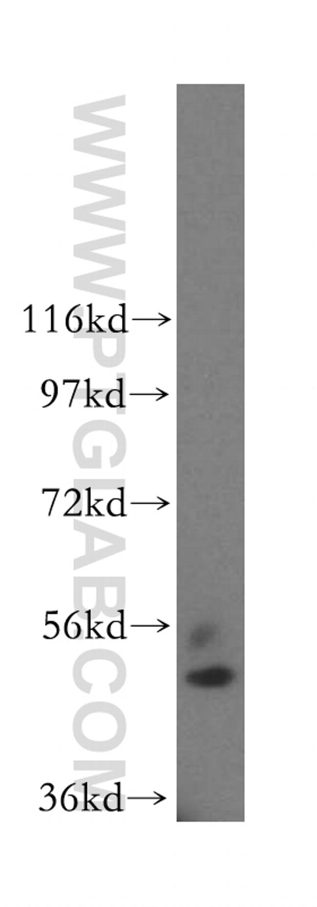 BHMT Antibody in Western Blot (WB)