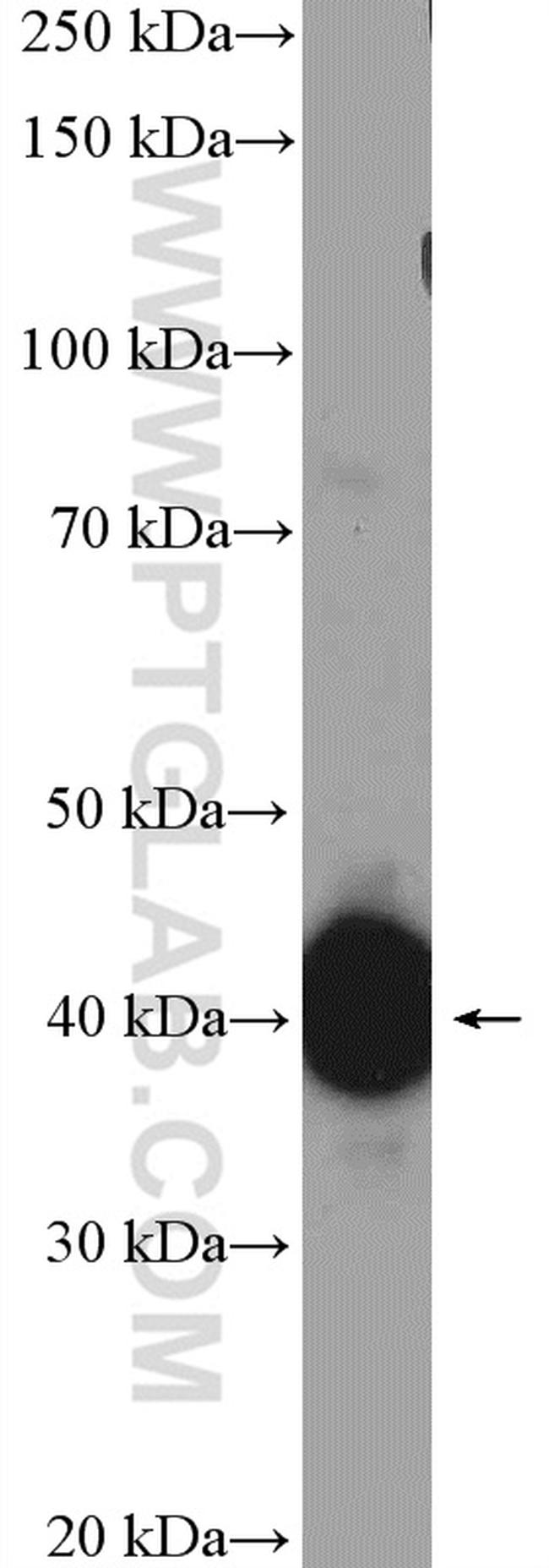 EBP2 Antibody in Western Blot (WB)