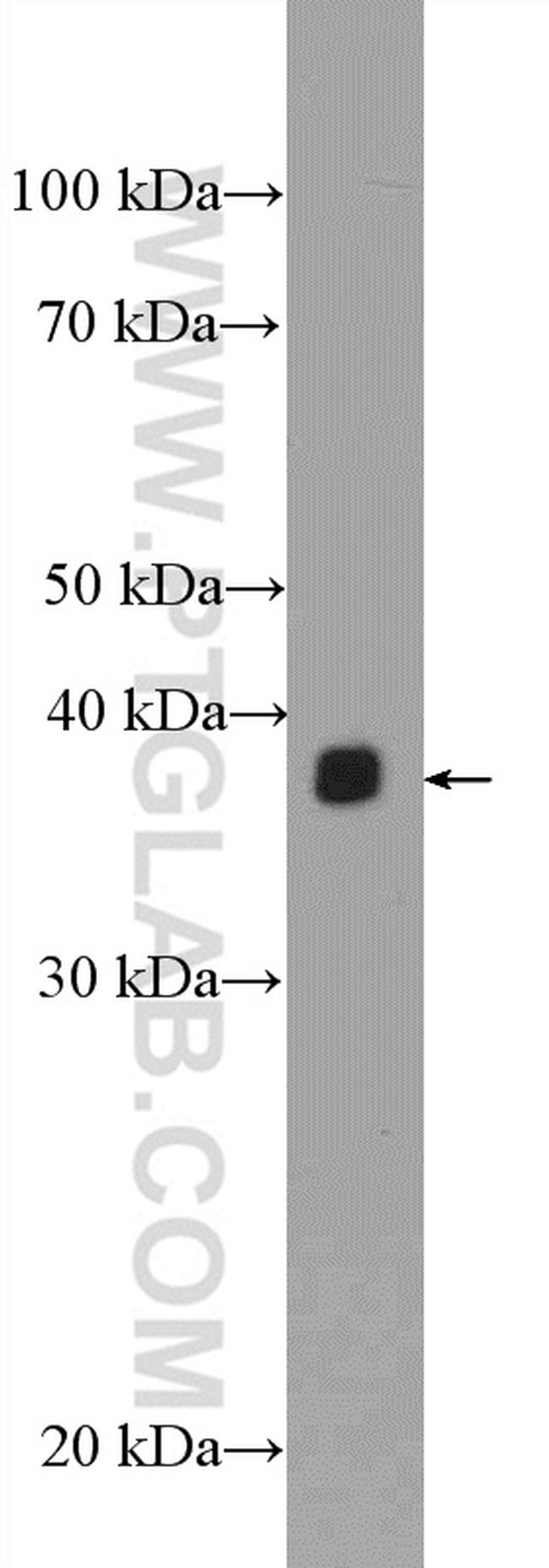 EBP2 Antibody in Western Blot (WB)