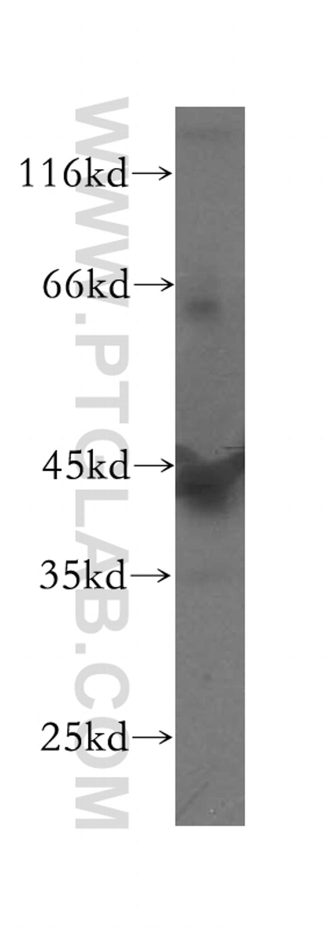 GTF2H2 Antibody in Western Blot (WB)