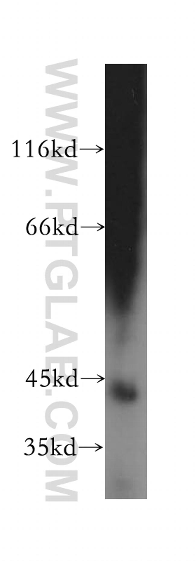 GTF2H2 Antibody in Western Blot (WB)