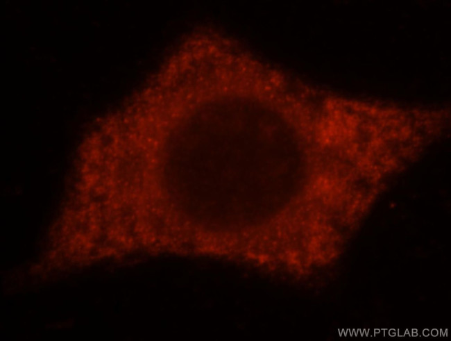 TXNDC4 Antibody in Immunocytochemistry (ICC/IF)