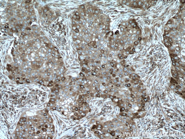 TXNDC4 Antibody in Immunohistochemistry (Paraffin) (IHC (P))