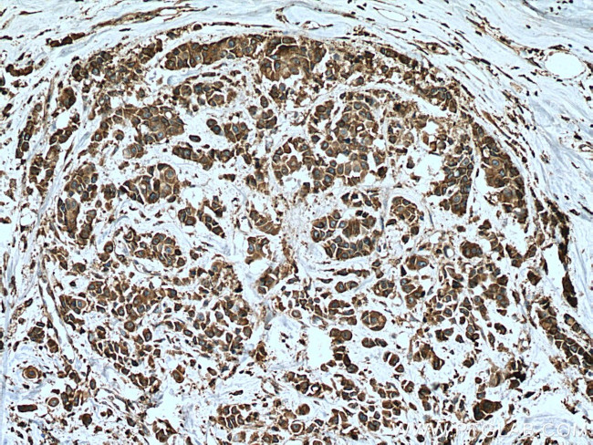 TXNDC4 Antibody in Immunohistochemistry (Paraffin) (IHC (P))