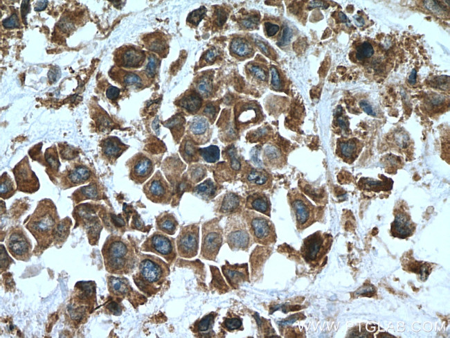 TXNDC4 Antibody in Immunohistochemistry (Paraffin) (IHC (P))