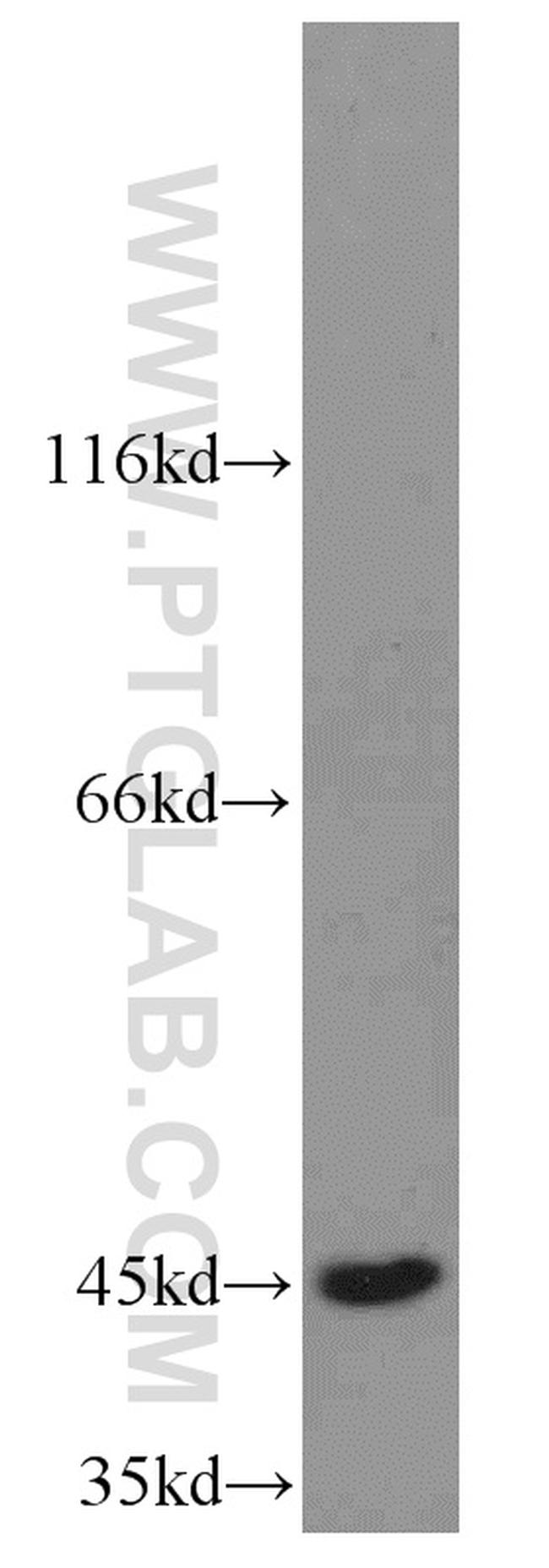 TXNDC4 Antibody in Western Blot (WB)