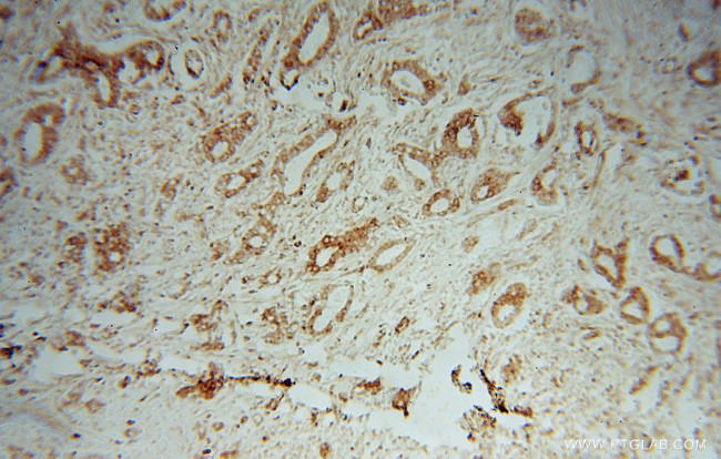 TXNDC4 Antibody in Immunohistochemistry (Paraffin) (IHC (P))