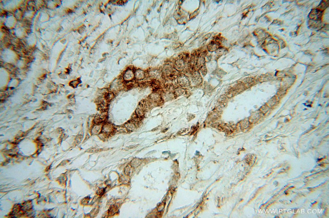 TXNDC4 Antibody in Immunohistochemistry (Paraffin) (IHC (P))