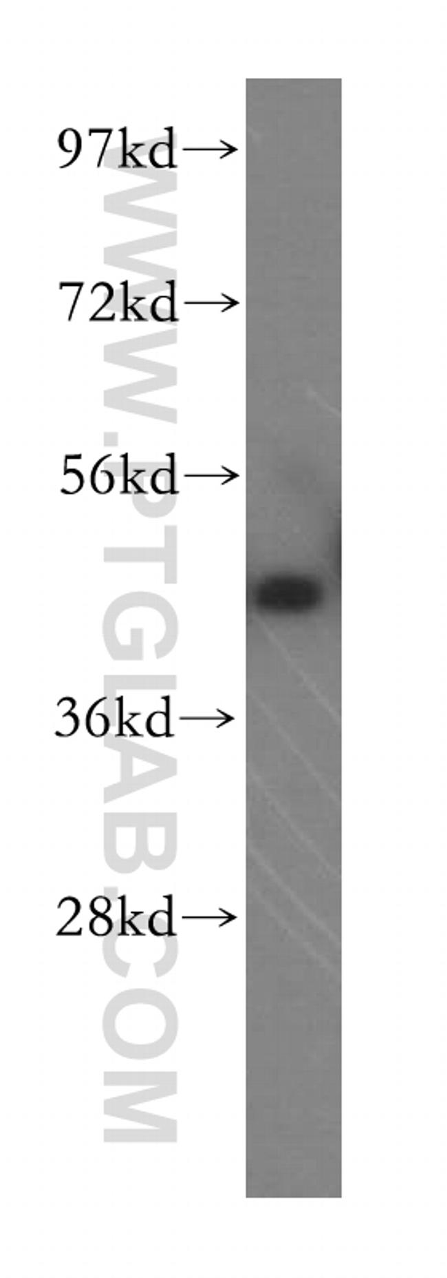 TXNDC4 Antibody in Western Blot (WB)