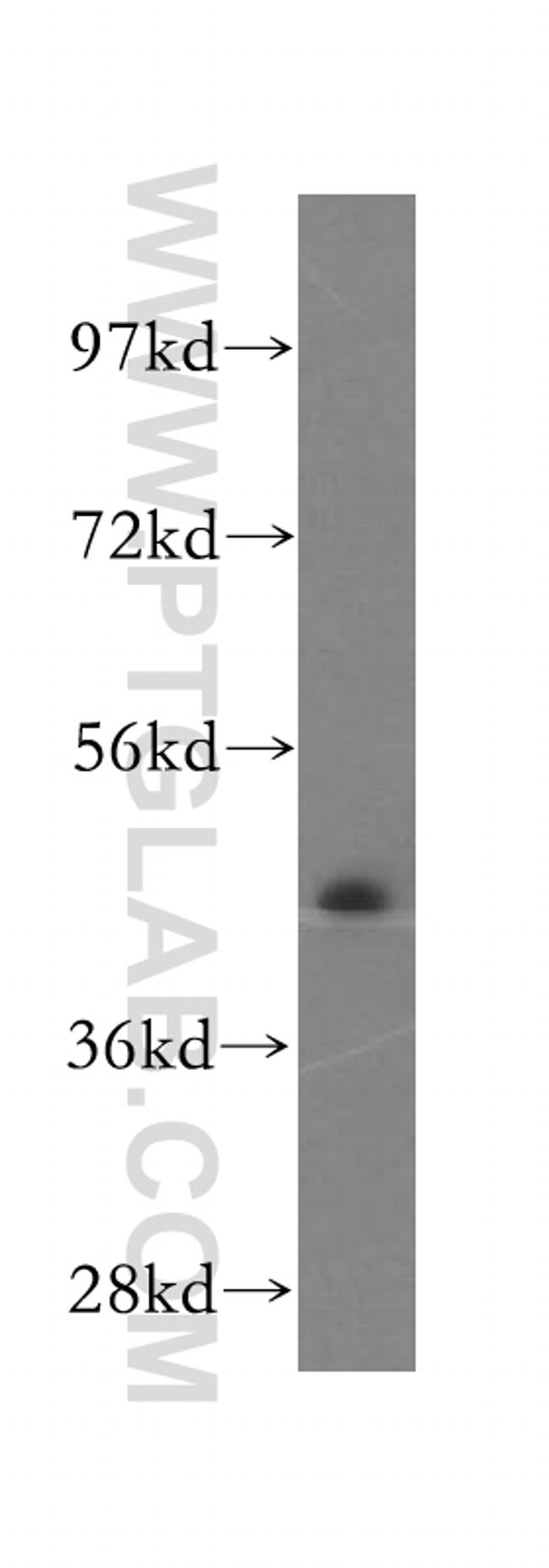 TXNDC4 Antibody in Western Blot (WB)