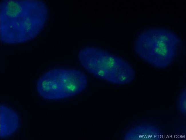 FBL Antibody in Immunocytochemistry (ICC/IF)