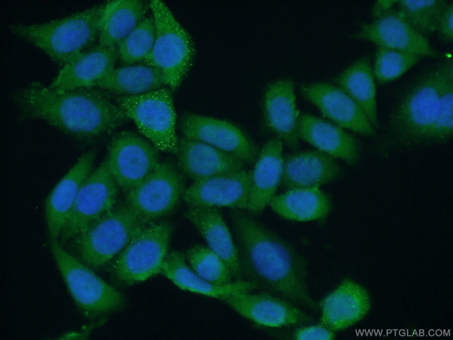 NMD3 Antibody in Immunocytochemistry (ICC/IF)