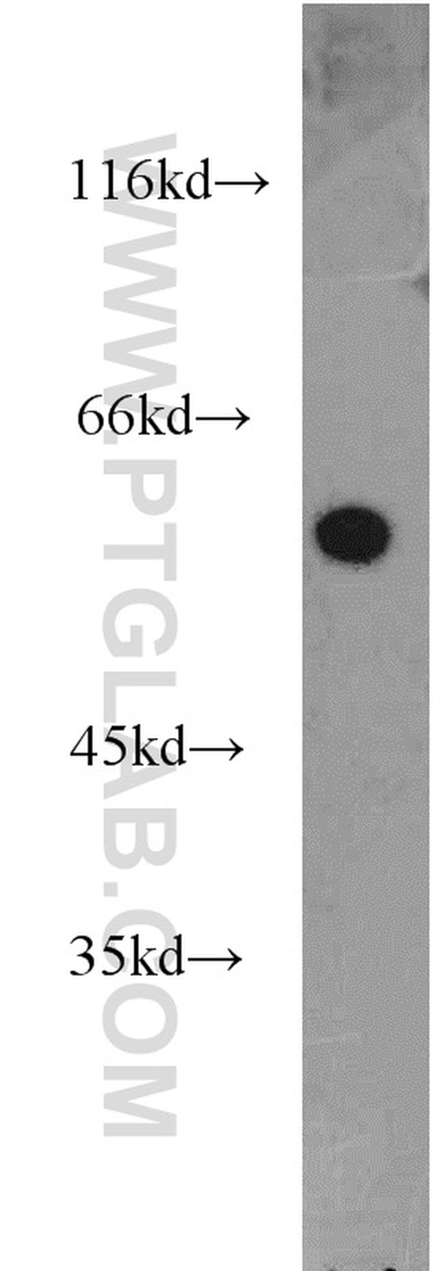 NMD3 Antibody in Western Blot (WB)