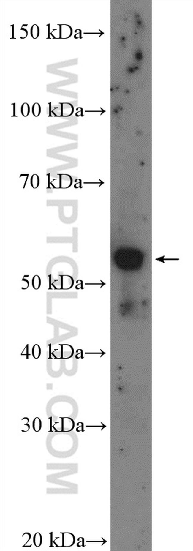 CYP39A1 Antibody in Western Blot (WB)