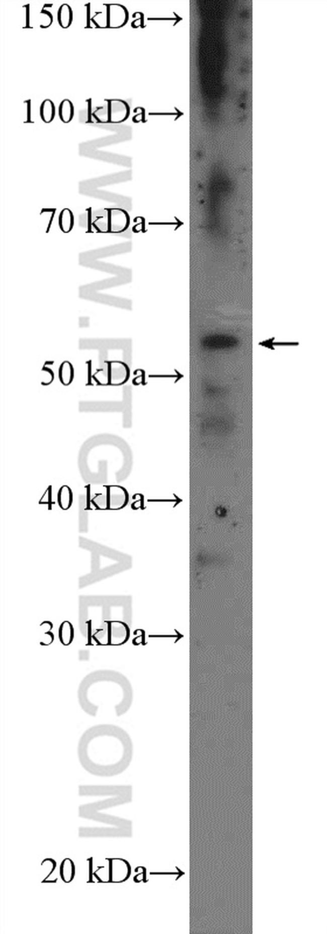 CYP39A1 Antibody in Western Blot (WB)