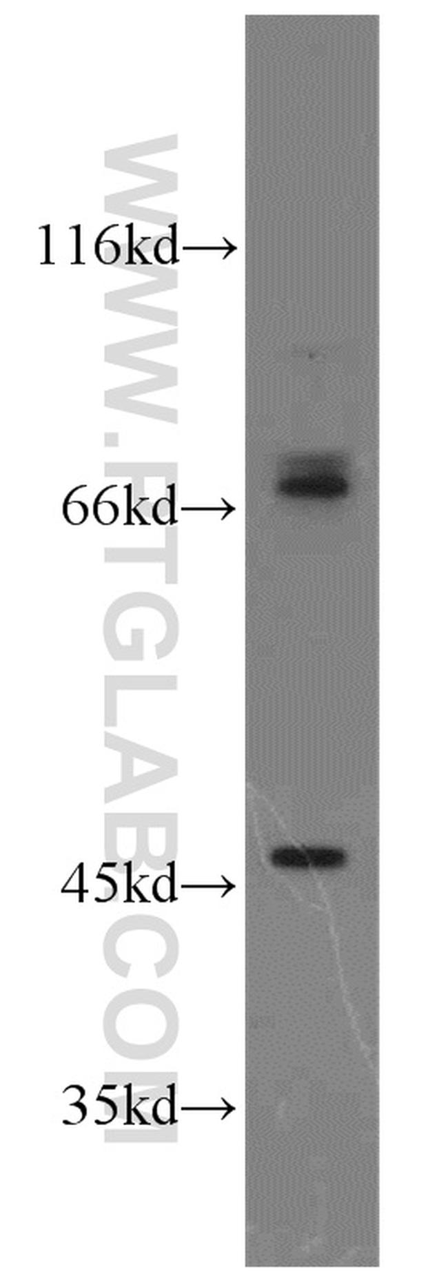 PIAS2 Antibody in Western Blot (WB)