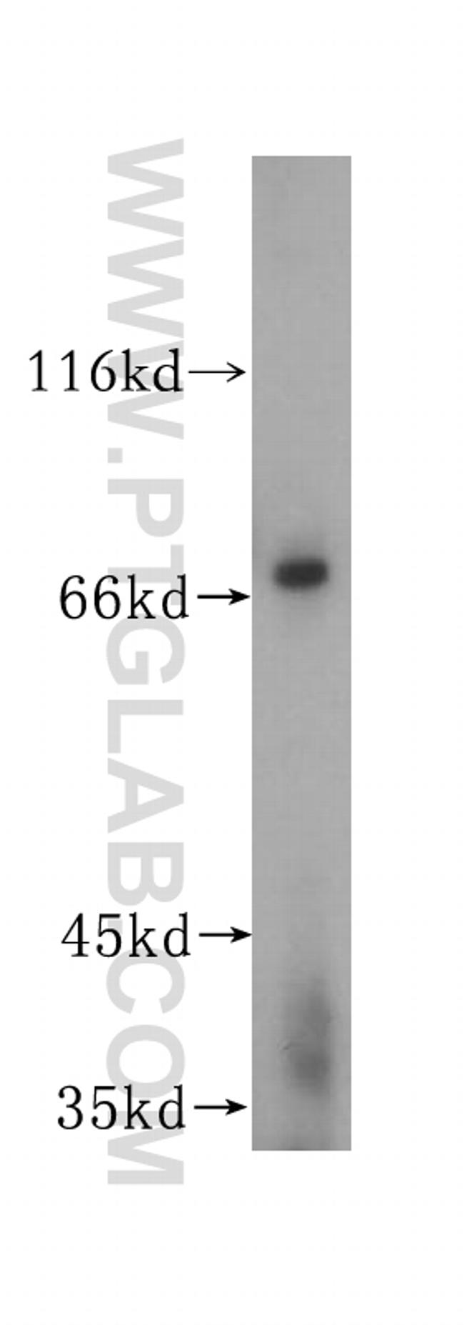 PIAS2 Antibody in Western Blot (WB)