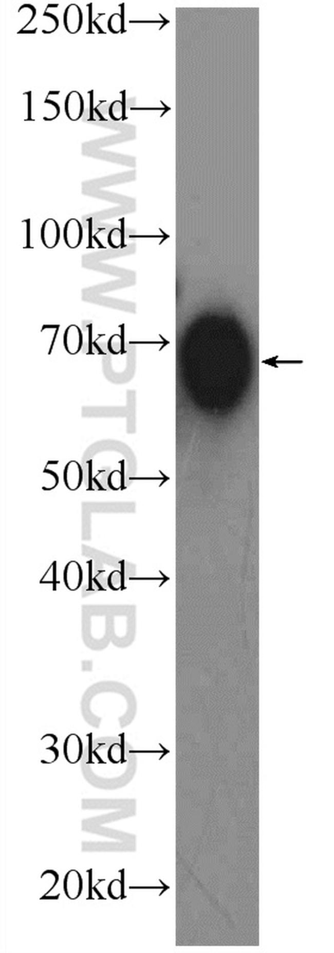 TCN1 Antibody in Western Blot (WB)