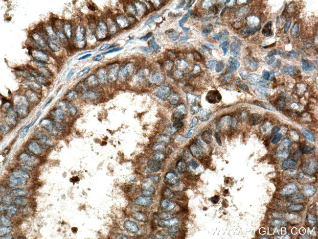 TrpRS Antibody in Immunohistochemistry (Paraffin) (IHC (P))