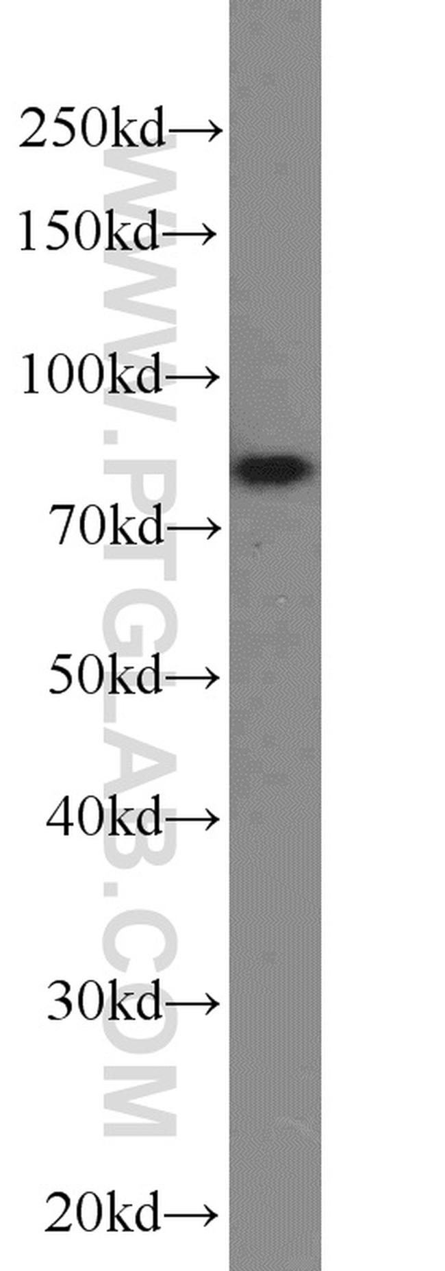 NOL9 Antibody in Western Blot (WB)