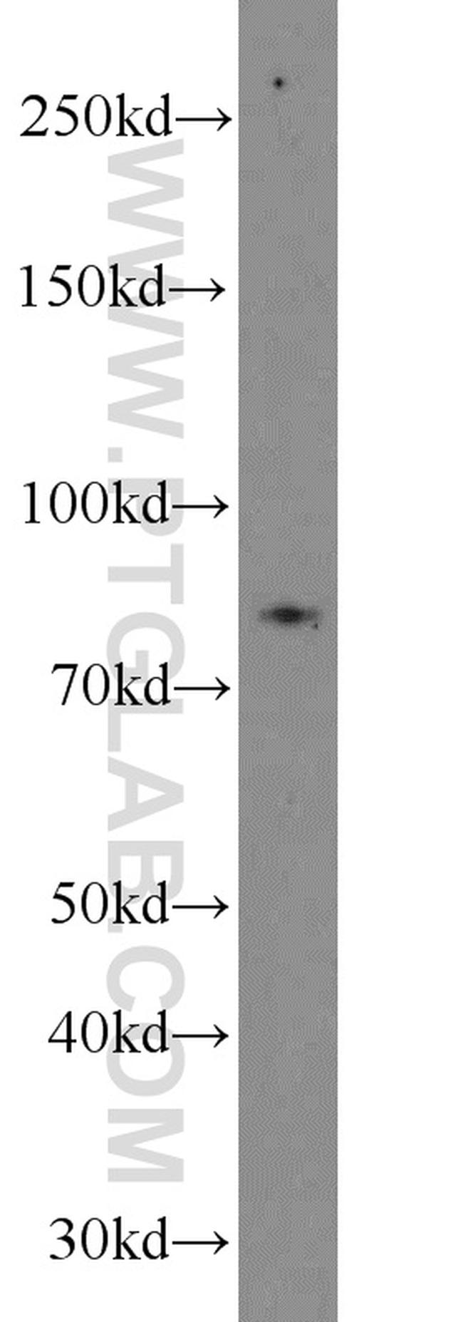 NOL9 Antibody in Western Blot (WB)