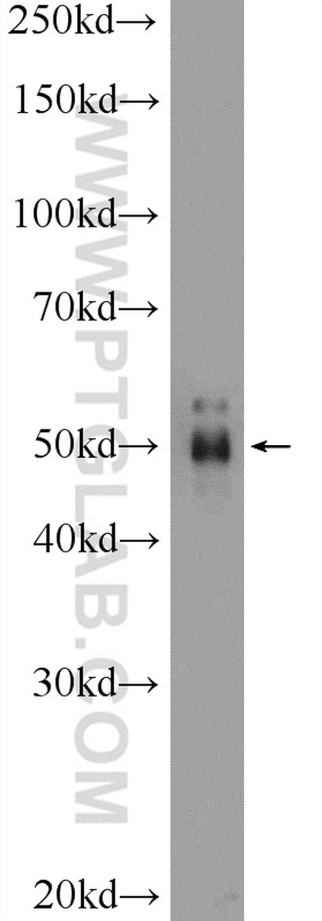 PELI2 Antibody in Western Blot (WB)