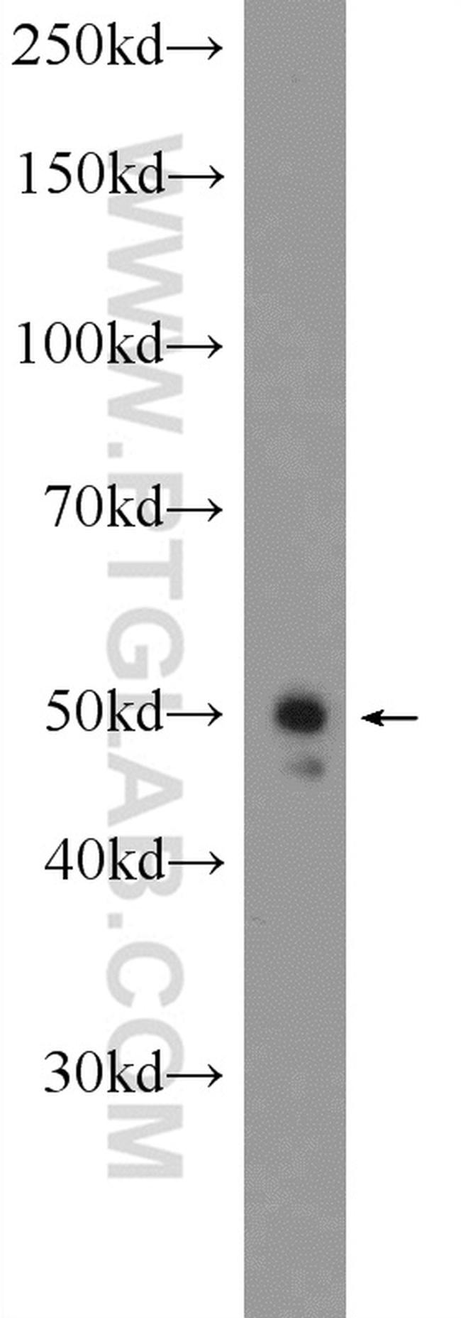 PELI2 Antibody in Western Blot (WB)