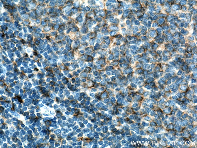 HLA-DPA1 Antibody in Immunohistochemistry (Paraffin) (IHC (P))