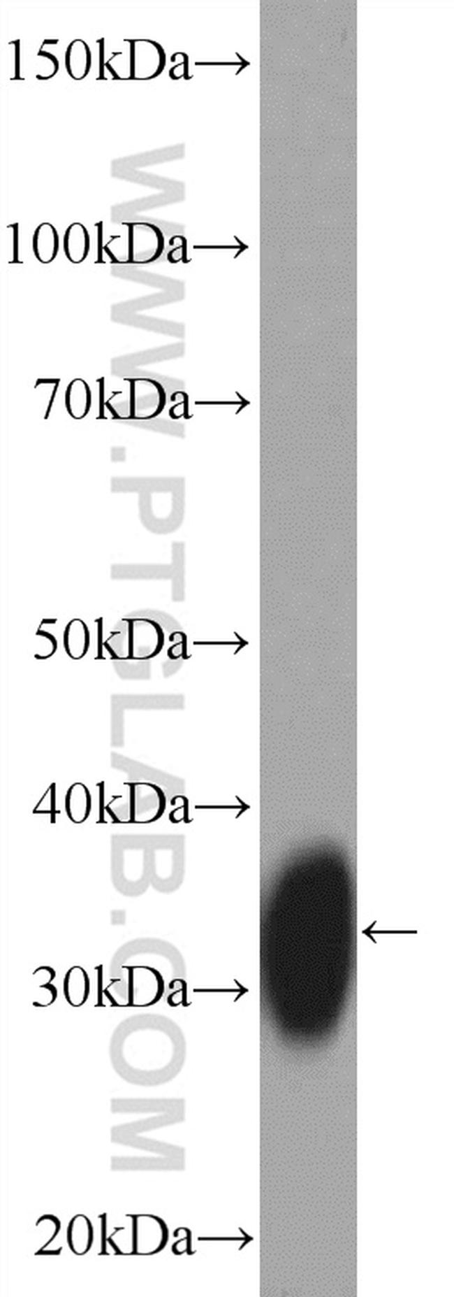 HLA-DPA1 Antibody in Western Blot (WB)