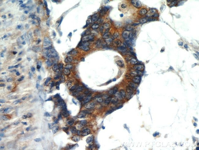 LPCAT1 Antibody in Immunohistochemistry (Paraffin) (IHC (P))