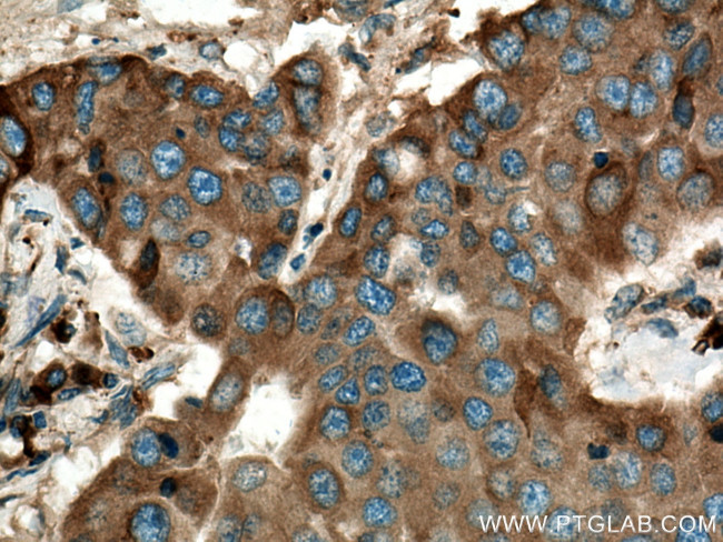 LPCAT1 Antibody in Immunohistochemistry (Paraffin) (IHC (P))