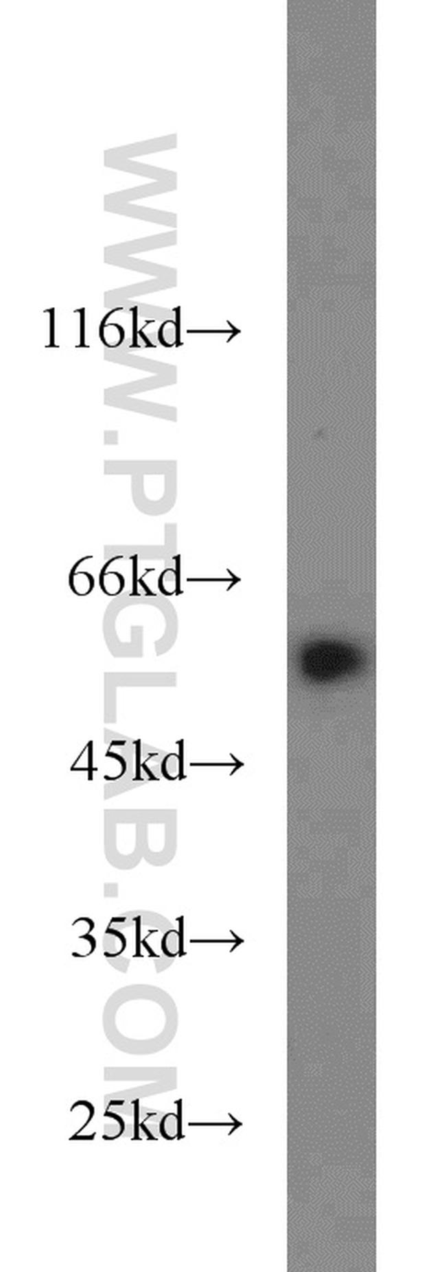 LPCAT1 Antibody in Western Blot (WB)