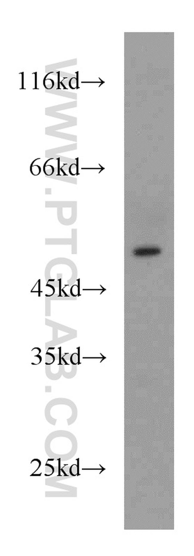 HMBOX1 Antibody in Western Blot (WB)