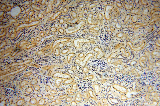 LAD1 Antibody in Immunohistochemistry (Paraffin) (IHC (P))