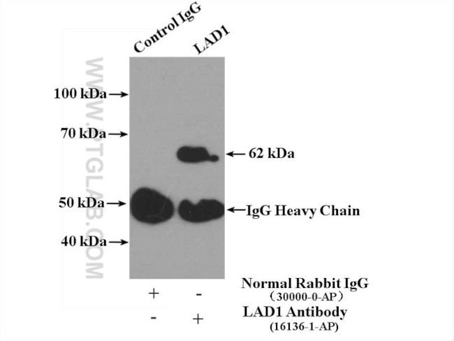 LAD1 Antibody in Immunoprecipitation (IP)