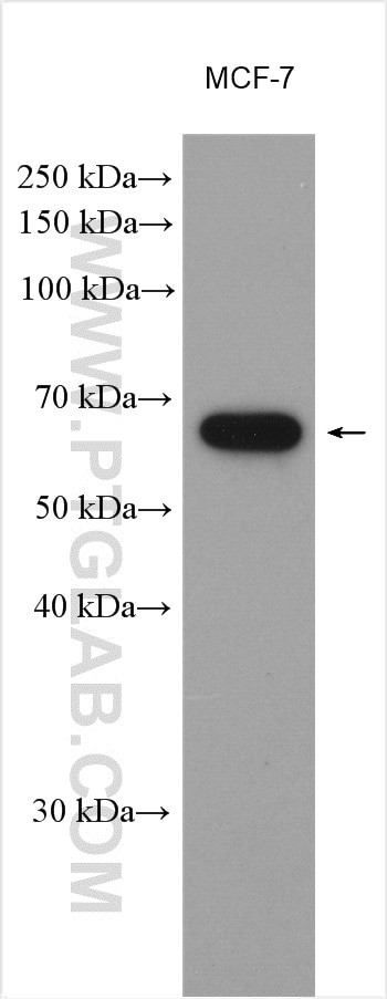 LAD1 Antibody in Western Blot (WB)