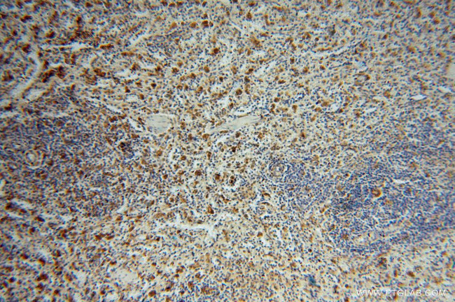 ATP6V1G1 Antibody in Immunohistochemistry (Paraffin) (IHC (P))